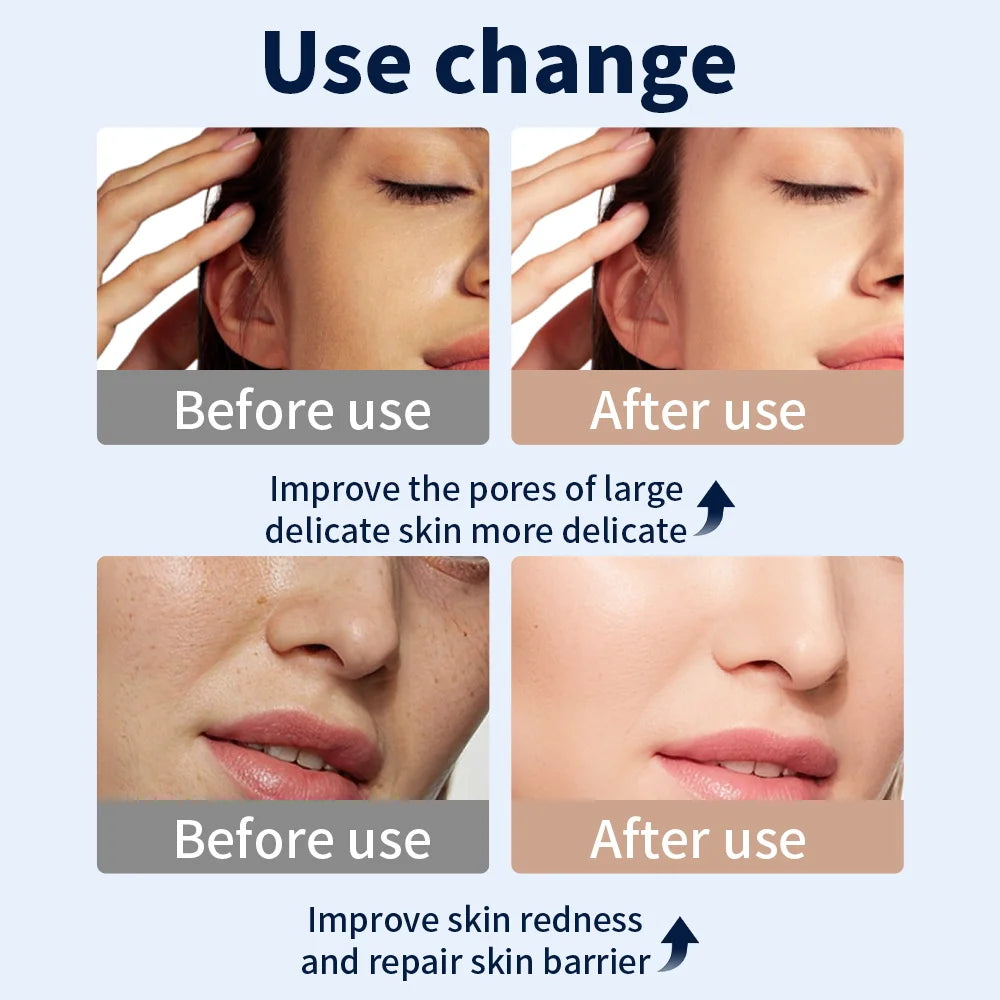 Radiant Glow LED Face Mask